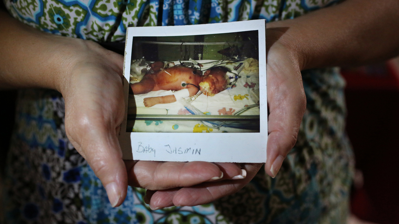 A mother holds a photo of her newborn baby girl who was injure during delivery